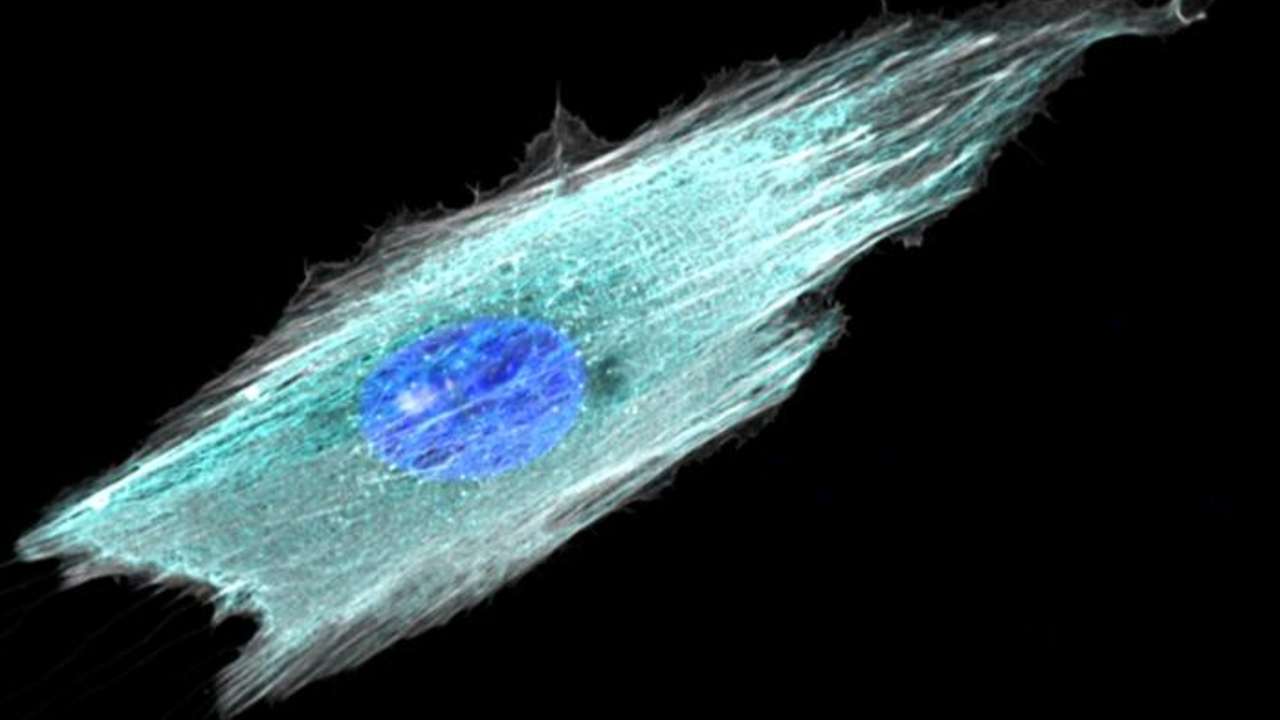 How a Cell Transmits Pressure From Its Surroundings to Its Nucleus