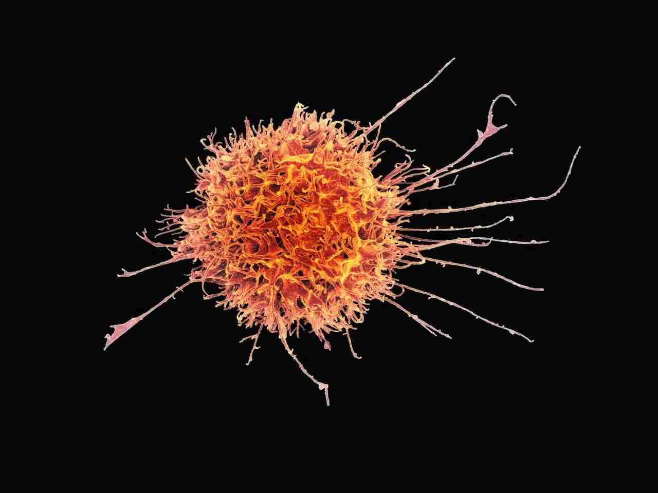 killer cell