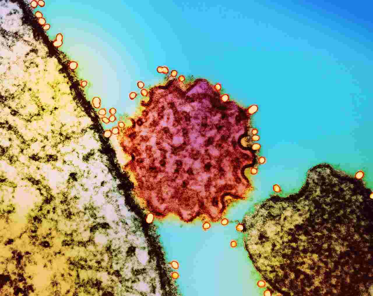 virus