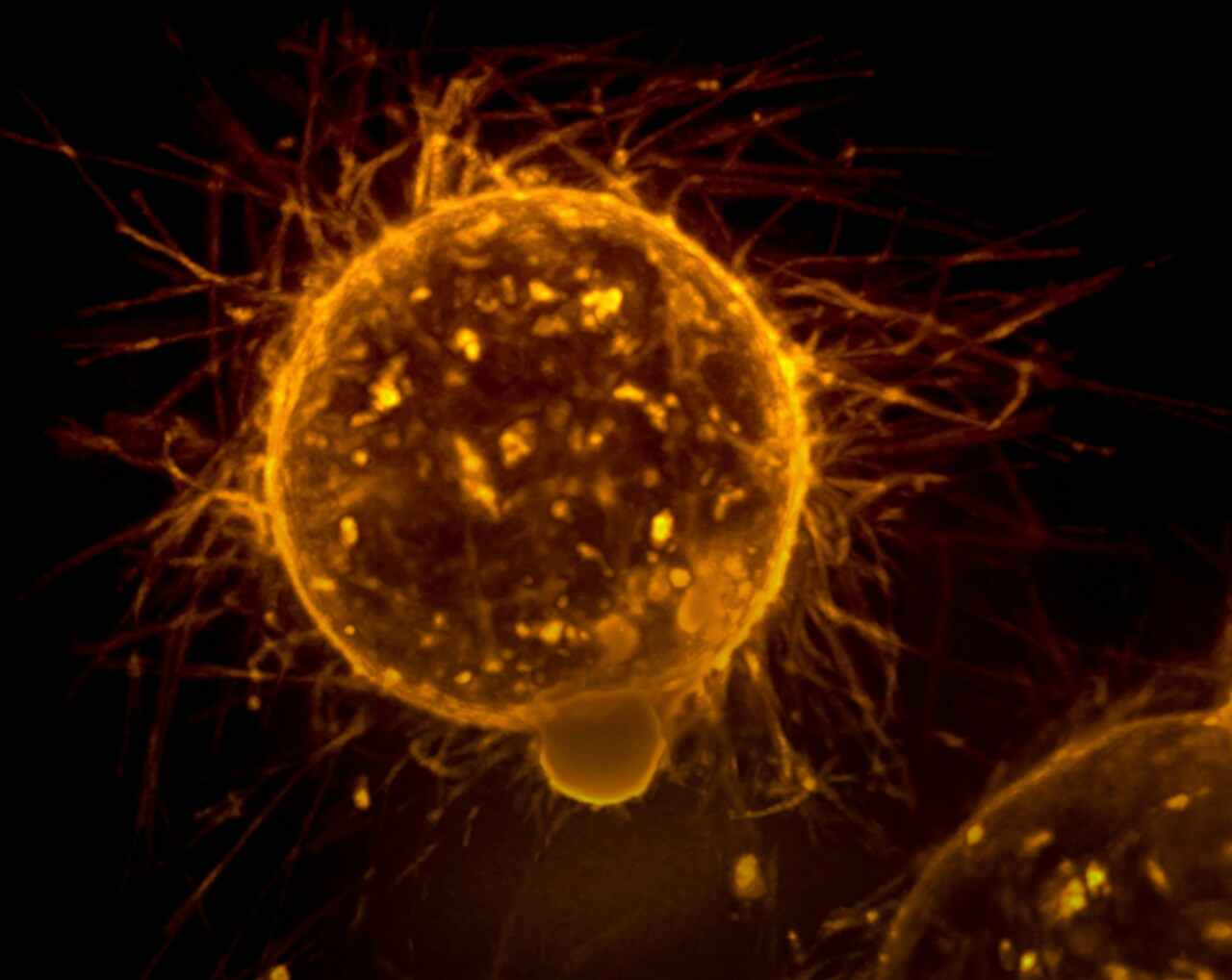 Metastasis